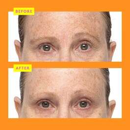 C-Firma™ Fresh Day - Serum