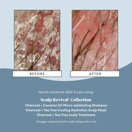 Scalp Revival™ - Scalp Treatment