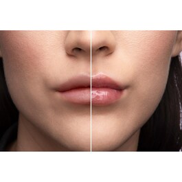 Lip Injection - Lip Balm