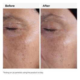 Glycolic Acid 7% - Toning Solution