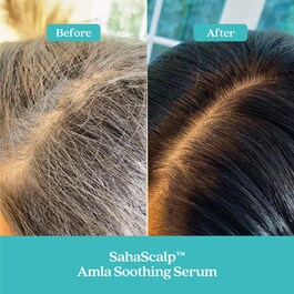 SahaScalp™ - Amla Soothing Scalp and Hair Serum