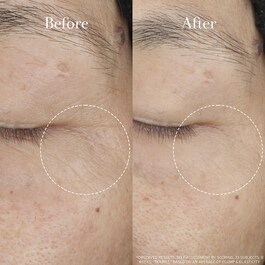 Tea Elixir Skin Resilience Activating Serum - Tea Elixir Hyaluronic Acid Serum 