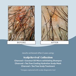 Scalp Revival™ - Micro-Exfoliating Shampoo