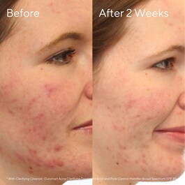 Clarifying Cleanser