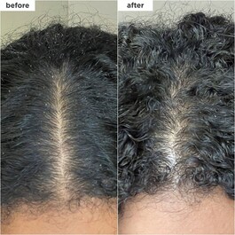 Scalp Revival - Charcoal + Coconut Oil Micro-exfoliating Scalp Shampoo