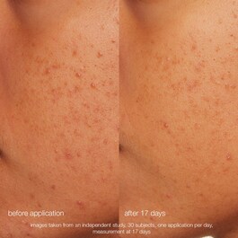Daily Microfoliant Exfoliator