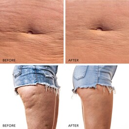 FOREO BEAR™ 2 body Fullkropps Mikroström Toningsapparat