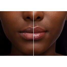 Lip Injection - Lip Balm
