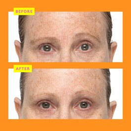 C-Firma™ Fresh Day - Serum
