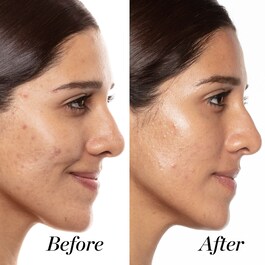 A+ High-Dose - Retinol Serum