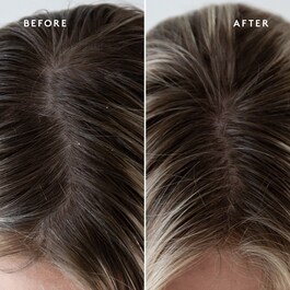 Topical - Scalp Supplement