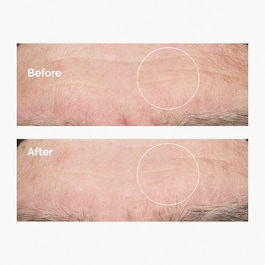 Hyaluronic Acid 2% + B5