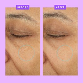 Ceramighty™ AF Eye Balm - Anti-aging eye cream