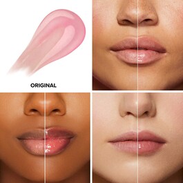 Lip Injection