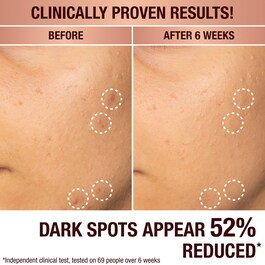 Dark Spot Correcting Radiance Recovery Serum - Serum mot pigmentfläckar