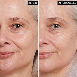 Anti-ageing ögoncreme med retionol