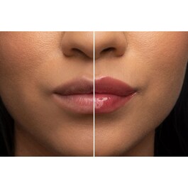 Lip Injection - Lip Balm