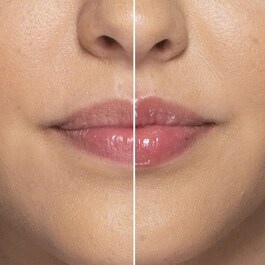 Lip Injection - Extreme