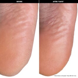 Exfoliating Foot Masks - Exfolierande fotmasker
