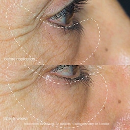Awaken Peptide Eye Gel - Eye contour gel