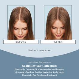 Scalp Revival™ - Scalp Treatment