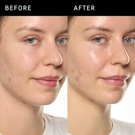 Ectoin Hydro-Barrier Serum - Återfuktande och skyddande serum