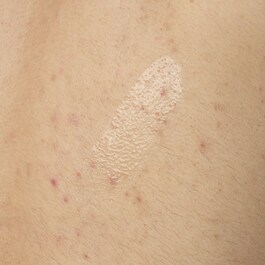 Salicylic Acid 0.5% Body Serum - Kroppsserum mot orenheter