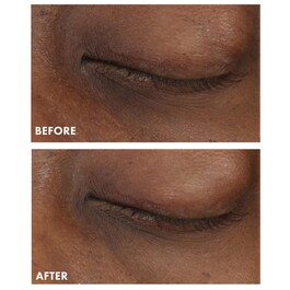 Ginzing Brightening Eye Cream