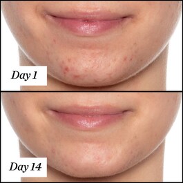 U.F.O. - Ultra-Clarifying Face Oil