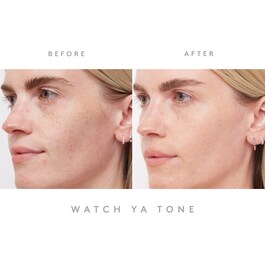 Watch Ya Tone - Niacinamide Dark Spot Serum