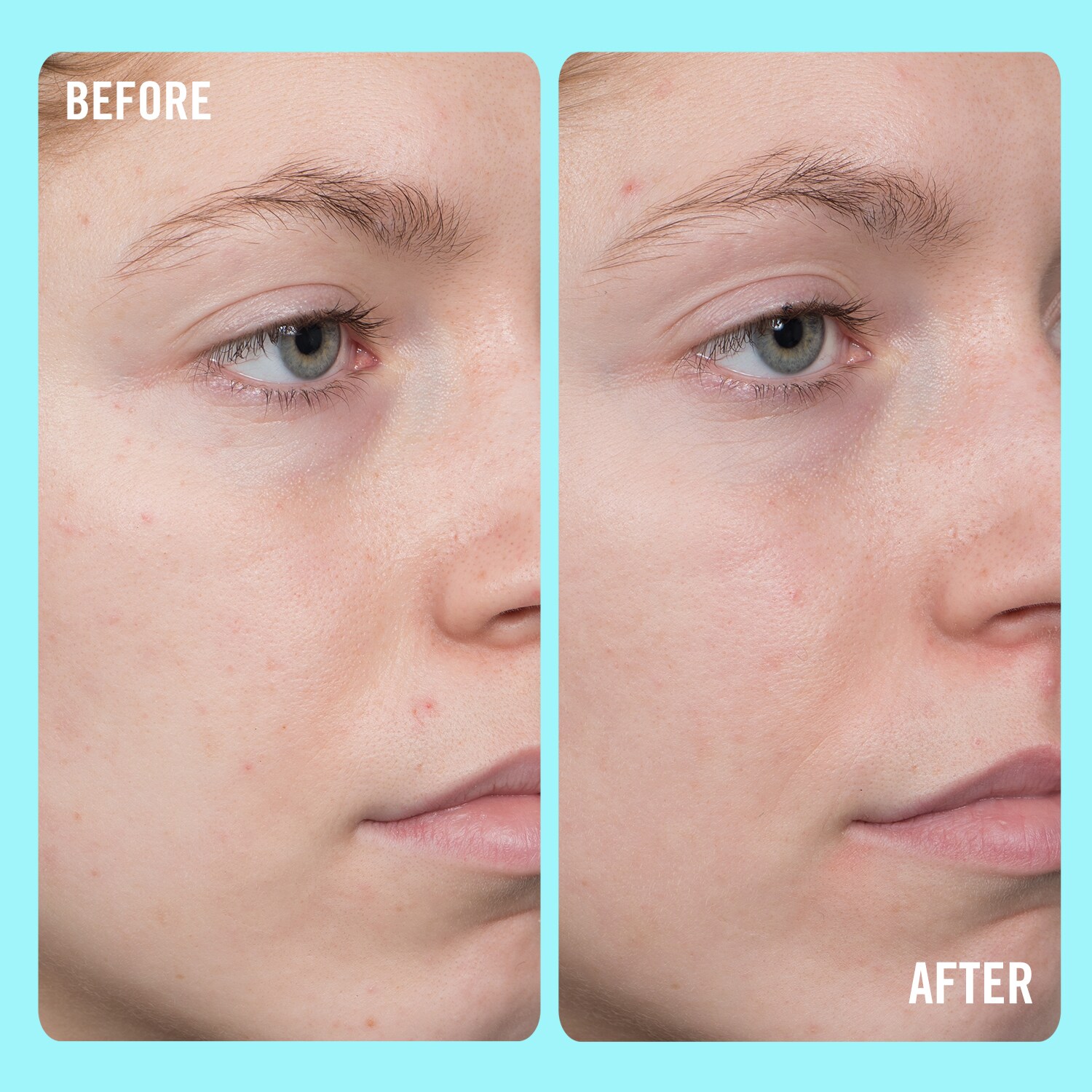 10 Vitamin C Brightening Serum FIRST AID BEAUTY ≡ SEPHORA